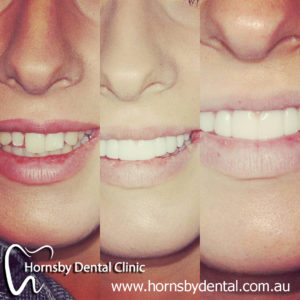 We have the best Orthodontist in Hornsby.