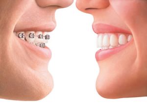 We are the best in orthodontics here in Hornsby.