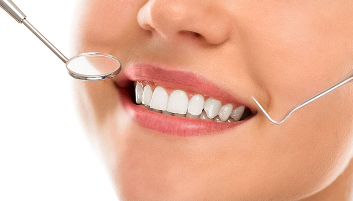 We are the best in teeth veneers in Hornsby.