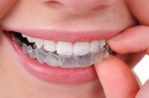 We are the best dentistry when it comes to Invisalign.