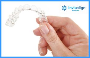 Invisalign Comprehensive