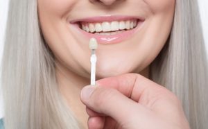 veneers teeth pros and cons