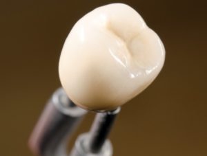 Dental Crowns in Hornsby